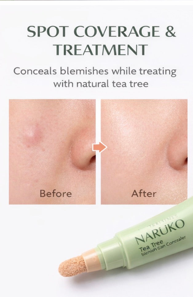 Anti-Acne Spot Concealer – Tea Tree