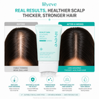 lilivele Scalp:Turn Cica PDRN Brush Ampoule | Scalp Soothing & Anti-Shedding Treatment 100ml
