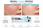 Dong-A D-Panthenol Ointment 5% | Skin Barrier Repair & Soothing Cream 50g