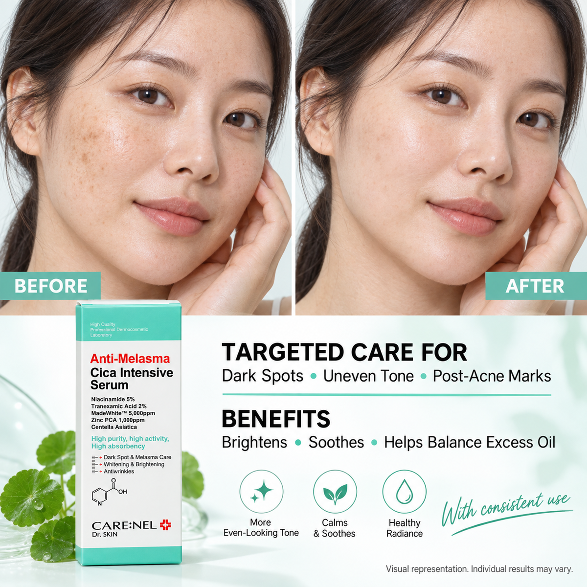 CARE:NEL Anti-Melasma Cica Intensive Serum – 30 ml