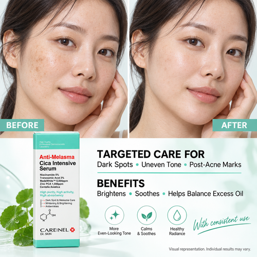 CARE:NEL Anti-Melasma Cica Intensive Serum – 30 ml
