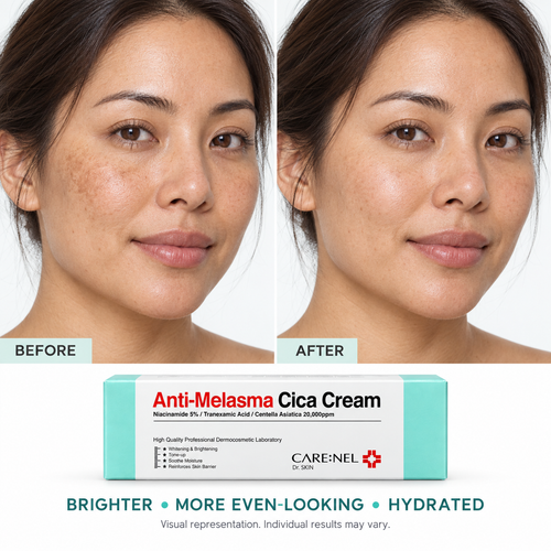 CARE:NEL Anti-Melasma Cica Brightening Cream – 40 ml