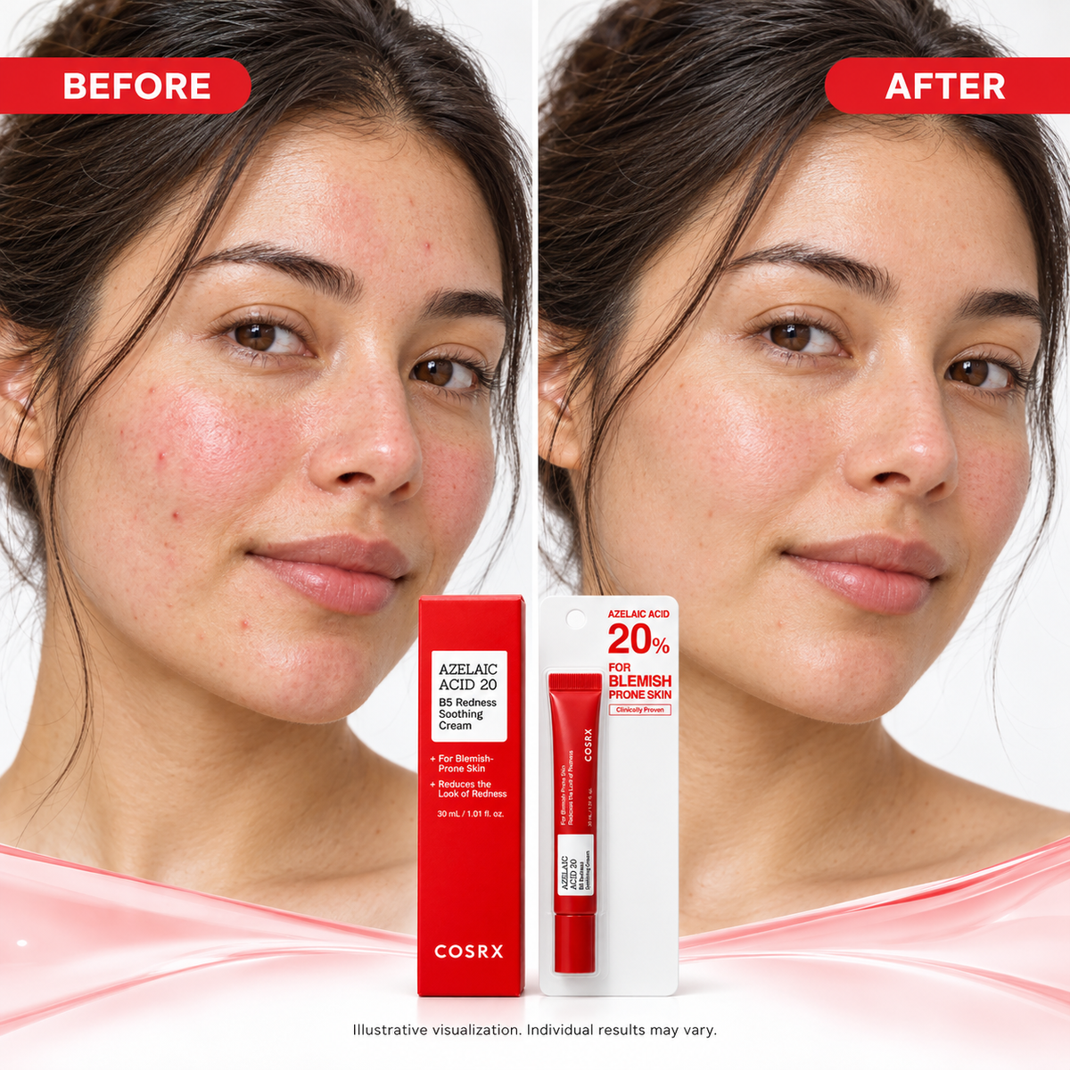 COSRX Azelaic Acid 20 B5 Redness Soothing Cream – 30 ml