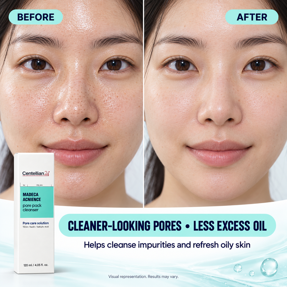 Centellian24 Madeca Acnience Pore Pack Cleanser – 120 ml