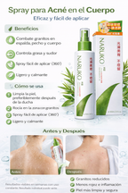 Naruko Spray para Acné de Espalda con Árbol de Té 100ml