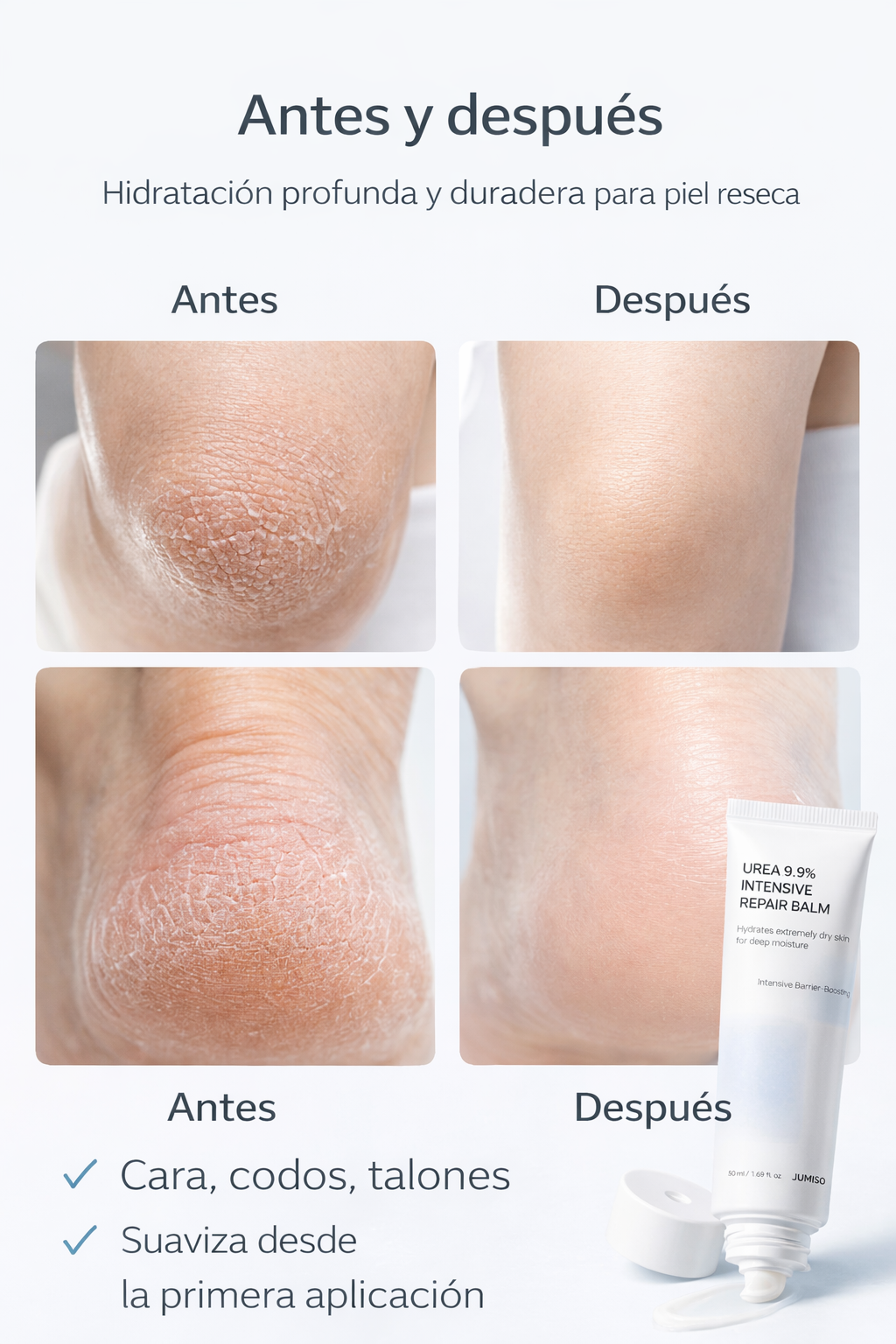 Urea 9.9% Intensive Repair Balm – Extreme Hydration for Dry Skin | Jumiso