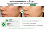 Aclean Gel Salicylic Acid Acne Treatment | Korean Gel for Acne and Blackheads