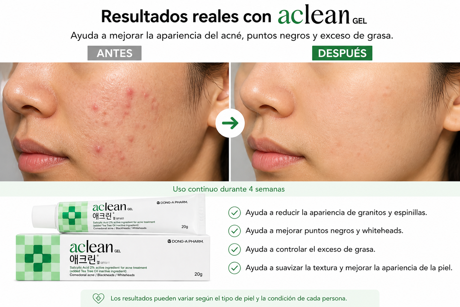 Aclean Gel Salicylic Acid Acne Treatment | Korean Gel for Acne and Blackheads